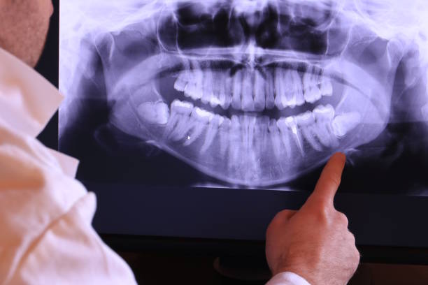 Best Orthodontic Emergency Dentist in Carmi, IL